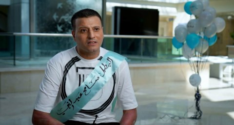 إنجاز طبي جديد يعكس ريادة مؤسسة ومستشفى أهل مصر لعلاج الحروق في مجال زراعة الجلد الطبيعي
