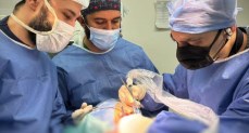 نجاح تدخل جراحي معقد لاستئصال ورم ضخم بقاع الجمجمة باستخدام تقنية VSP